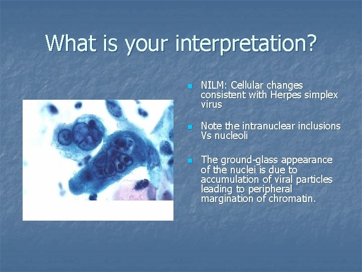 What is your interpretation? n n n NILM: Cellular changes consistent with Herpes simplex