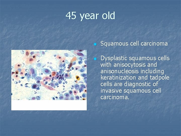 45 year old n n Squamous cell carcinoma Dysplastic squamous cells with anisocytosis and