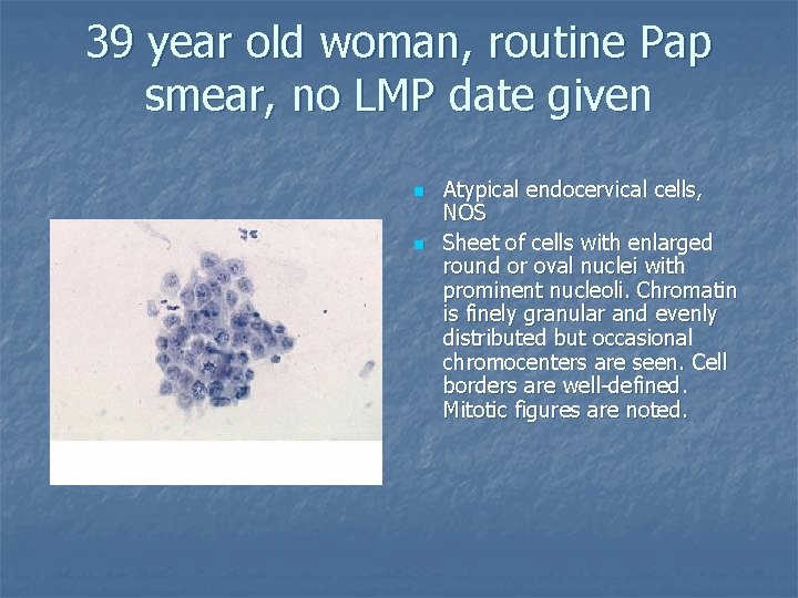 39 year old woman, routine Pap smear, no LMP date given n n Atypical