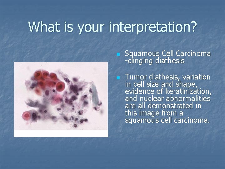 What is your interpretation? n n Squamous Cell Carcinoma -clinging diathesis Tumor diathesis, variation