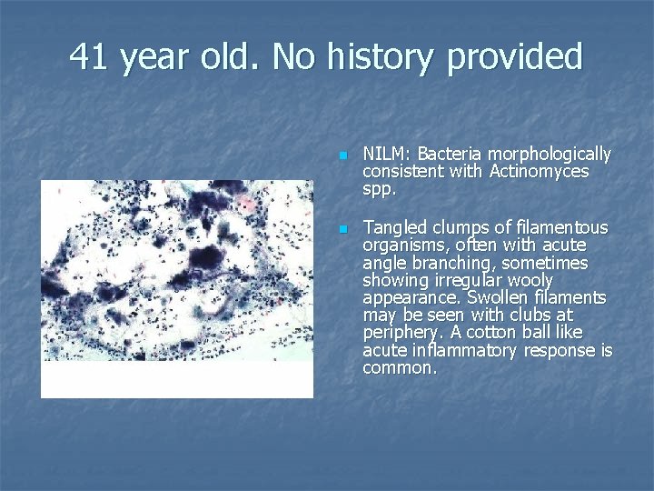 41 year old. No history provided n n NILM: Bacteria morphologically consistent with Actinomyces