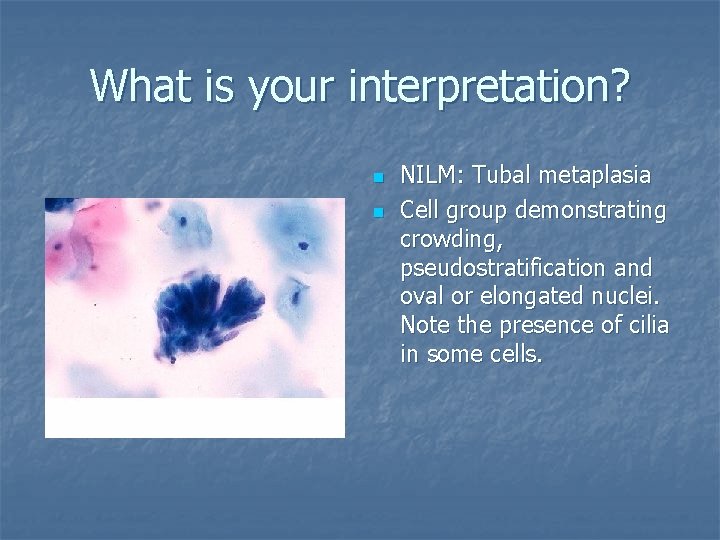 What is your interpretation? n n NILM: Tubal metaplasia Cell group demonstrating crowding, pseudostratification