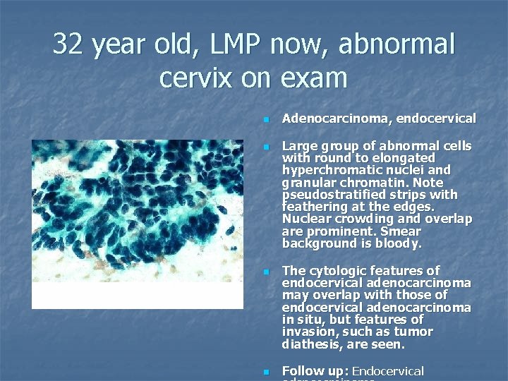 32 year old, LMP now, abnormal cervix on exam n n Adenocarcinoma, endocervical Large