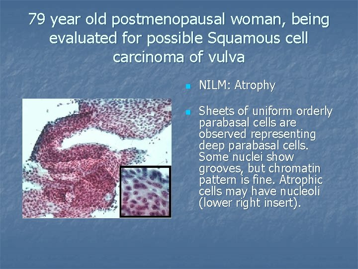 79 year old postmenopausal woman, being evaluated for possible Squamous cell carcinoma of vulva