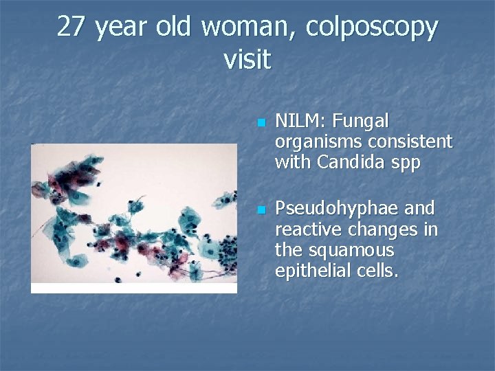 27 year old woman, colposcopy visit n n NILM: Fungal organisms consistent with Candida