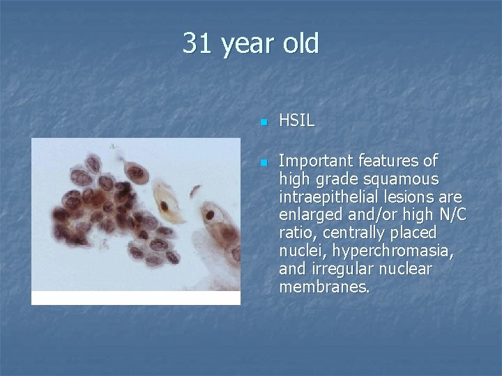 31 year old n n HSIL Important features of high grade squamous intraepithelial lesions