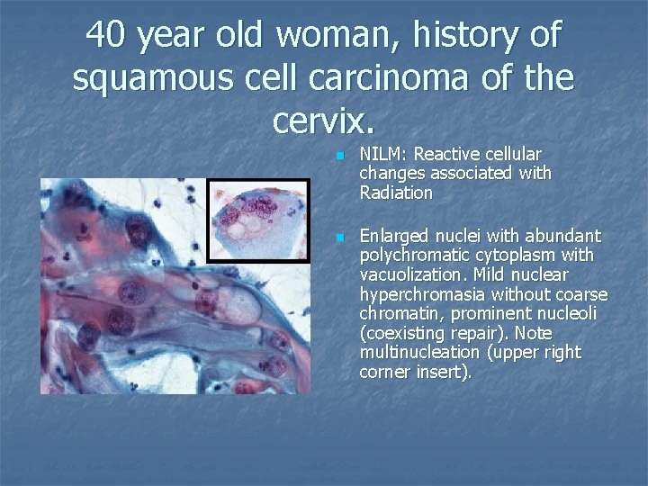 40 year old woman, history of squamous cell carcinoma of the cervix. n n