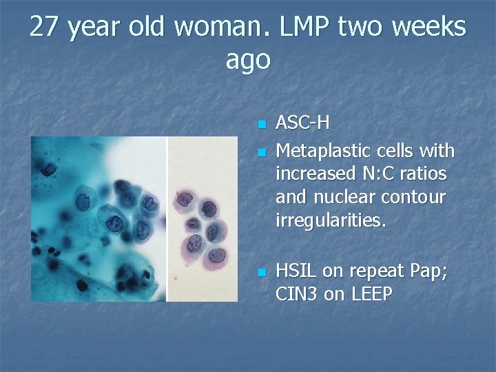 27 year old woman. LMP two weeks ago n n n ASC-H Metaplastic cells