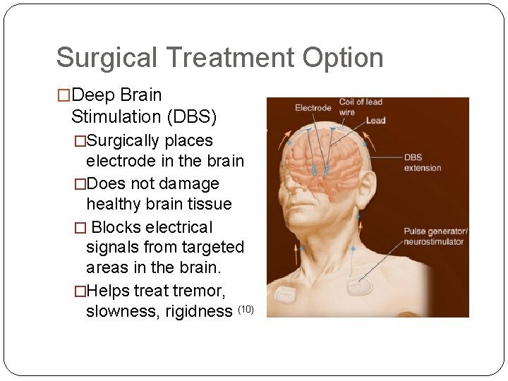Surgical Treatment Option �Deep Brain Stimulation (DBS) �Surgically places electrode in the brain �Does