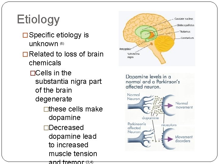 Etiology � Specific etiology is unknown (6) � Related to loss of brain chemicals