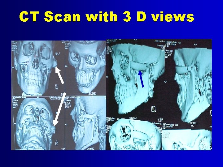 CT Scan with 3 D views 