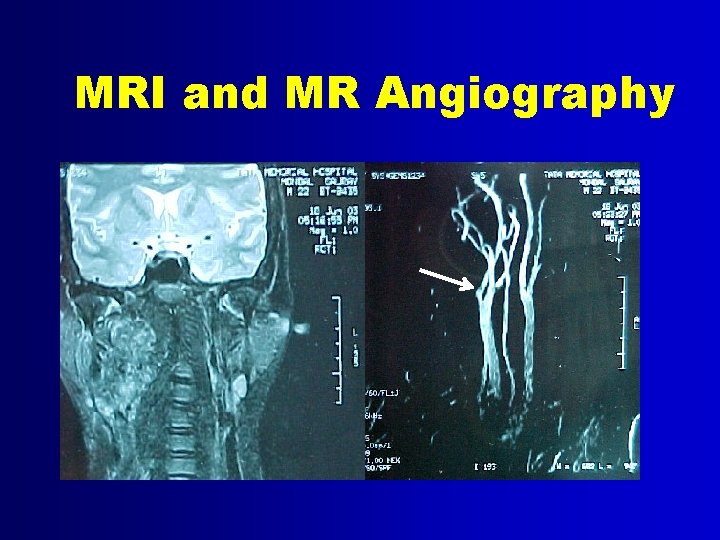 MRI and MR Angiography 