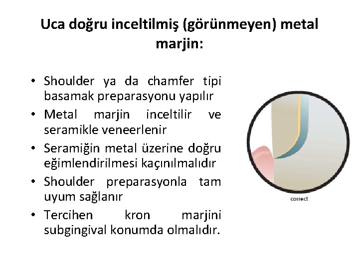 Uca doğru inceltilmiş (görünmeyen) metal marjin: • Shoulder ya da chamfer tipi basamak preparasyonu