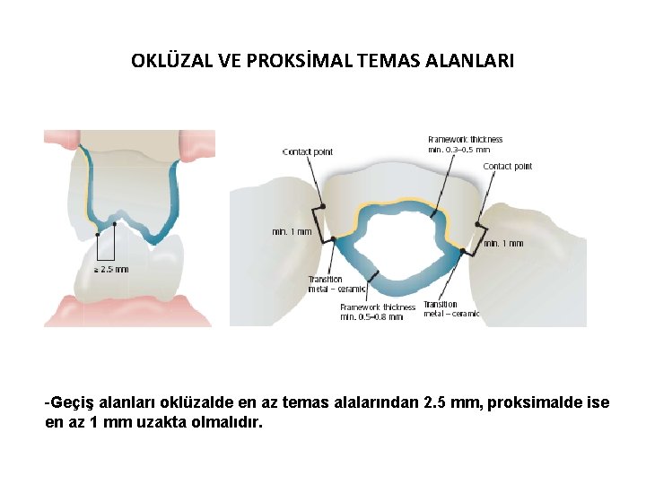 OKLÜZAL VE PROKSİMAL TEMAS ALANLARI -Geçiş alanları oklüzalde en az temas alalarından 2. 5