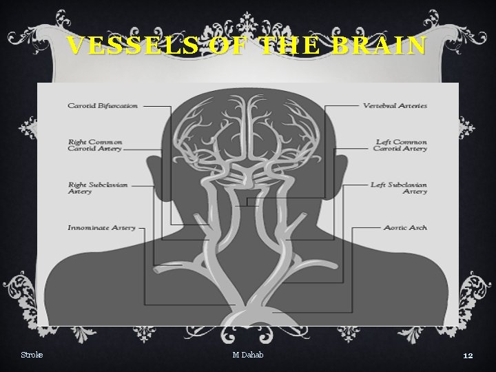 VESSELS OF THE BRAIN Stroke M Dahab 12 