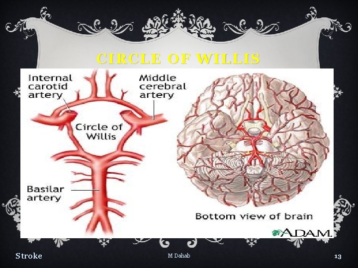 CIRCLE OF WILLIS Stroke M Dahab 13 