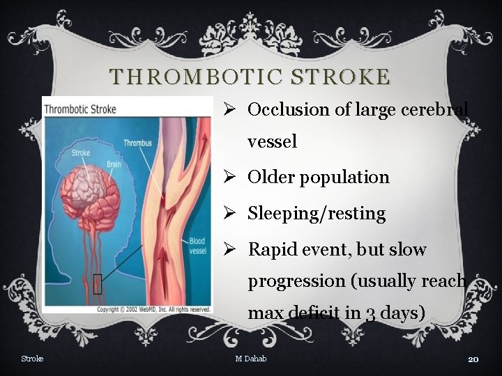 THROMBOTIC STROKE Ø Occlusion of large cerebral vessel Ø Older population Ø Sleeping/resting Ø