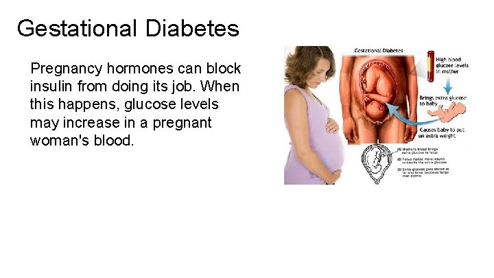 Gestational Diabetes Pregnancy hormones can block insulin from doing its job. When this happens,