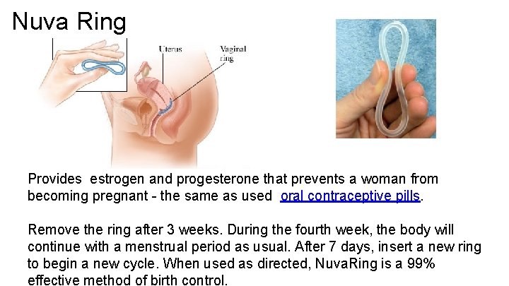 Nuva Ring Provides estrogen and progesterone that prevents a woman from becoming pregnant -