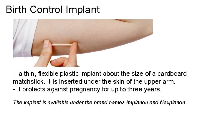 Birth Control Implant - a thin, flexible plastic implant about the size of a