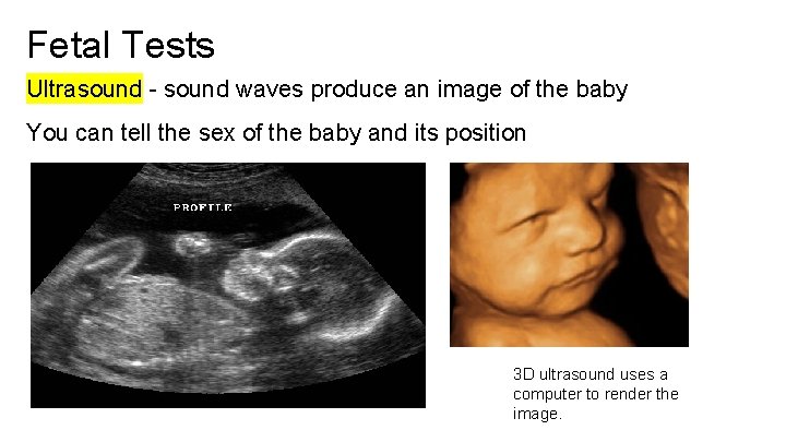 Fetal Tests Ultrasound - sound waves produce an image of the baby You can