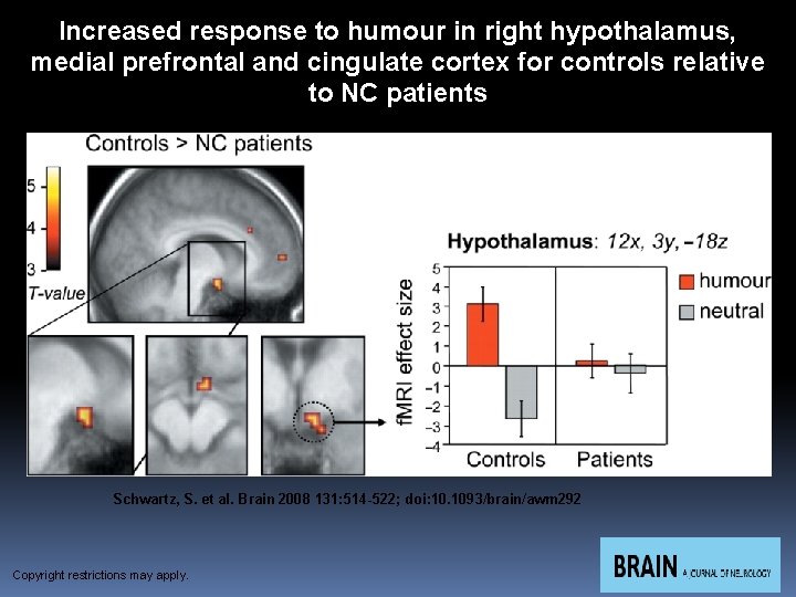 Increased response to humour in right hypothalamus, medial prefrontal and cingulate cortex for controls