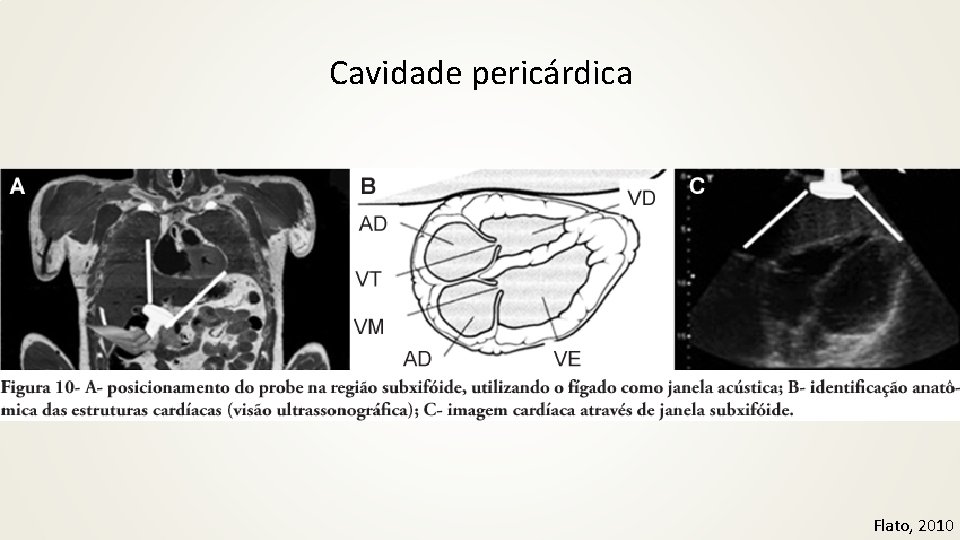 Cavidade pericárdica Flato, 2010 