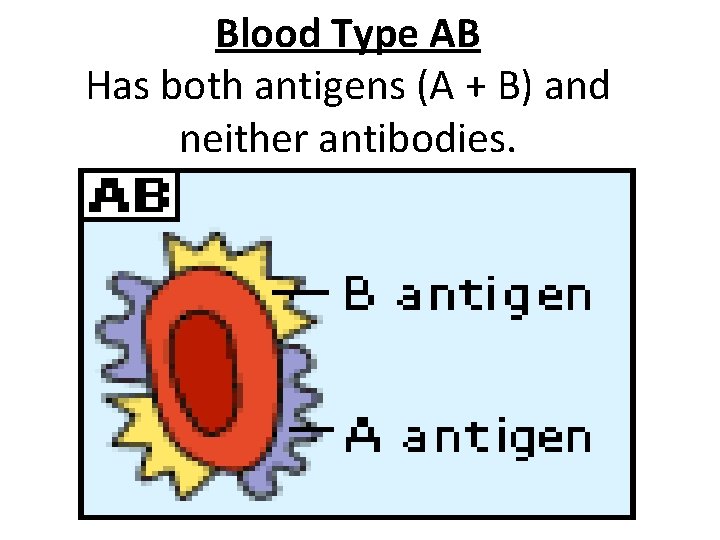 Blood Type AB Has both antigens (A + B) and neither antibodies. 