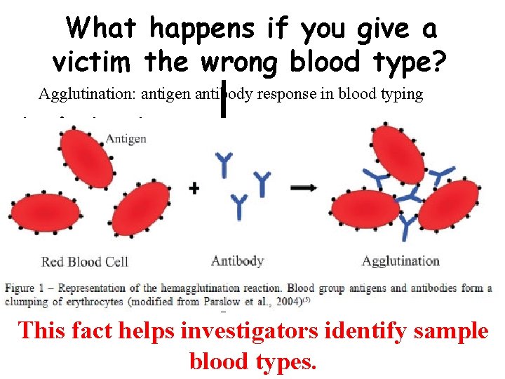 What happens if you give a victim the wrong blood type? Agglutination: antigen antibody