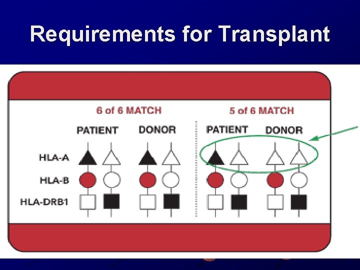 Requirements for Transplant 