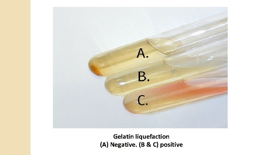 Gelatin liquefaction (A) Negative. (B & C) positive 