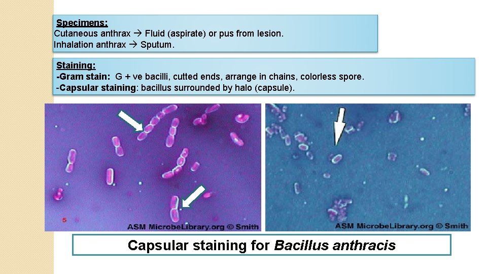 Specimens: Cutaneous anthrax Fluid (aspirate) or pus from lesion. Inhalation anthrax Sputum. Staining: -Gram