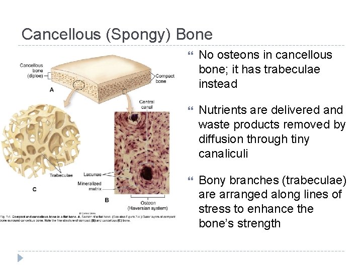 Cancellous (Spongy) Bone No osteons in cancellous bone; it has trabeculae instead Nutrients are
