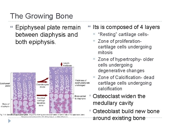 The Growing Bone Epiphyseal plate remain between diaphysis and both epiphysis. Its is composed