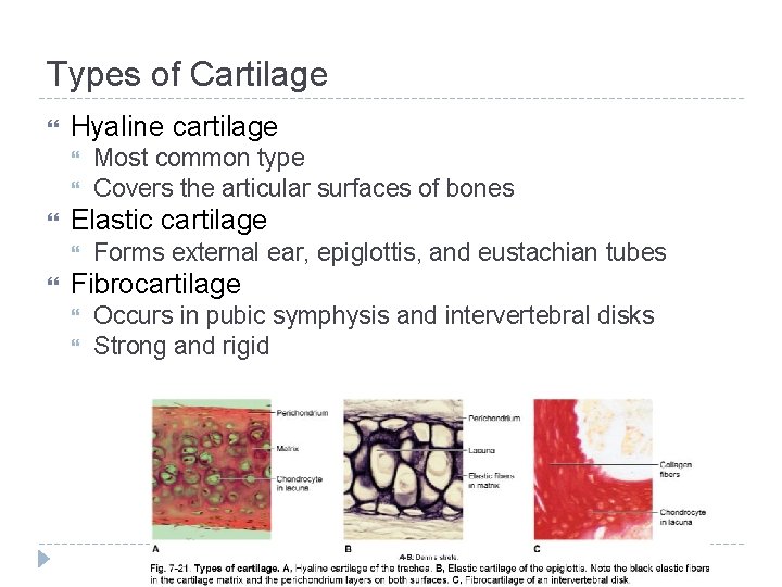Types of Cartilage Hyaline cartilage Elastic cartilage Most common type Covers the articular surfaces