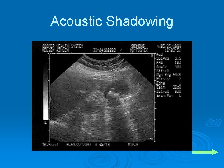 Acoustic Shadowing 