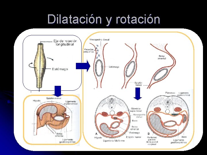 Dilatación y rotación 