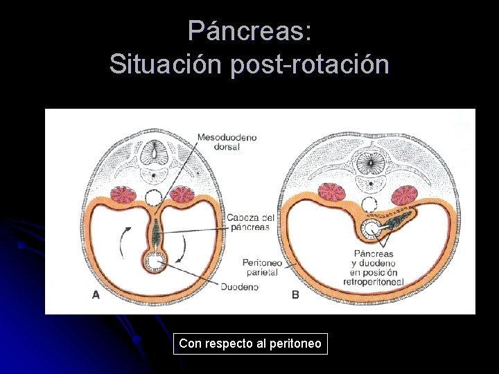 Páncreas: Situación post-rotación Con respecto al peritoneo 