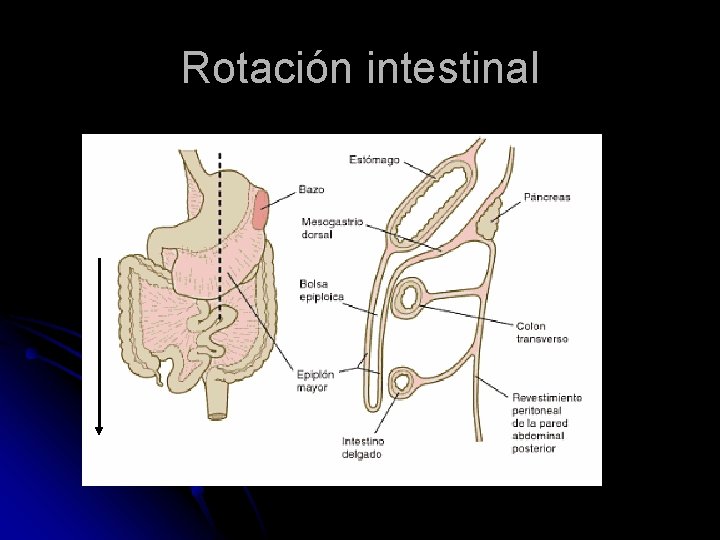 Rotación intestinal 