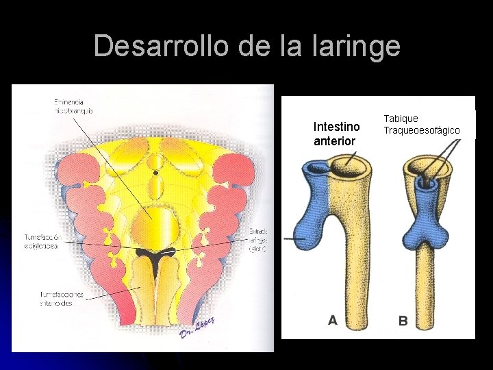 Desarrollo de la laringe Intestino anterior Tabique Traqueoesofágico 