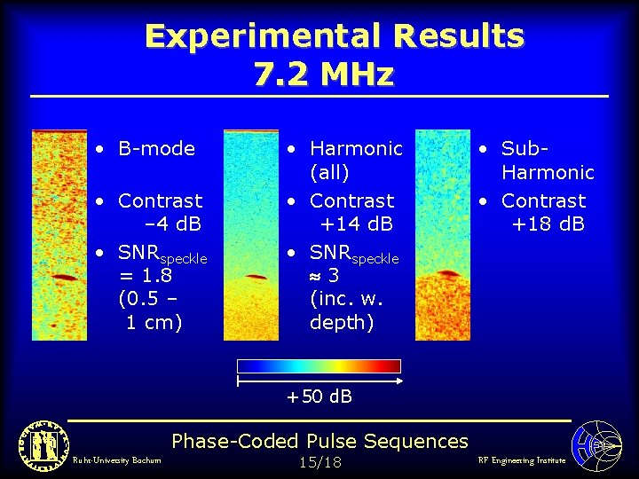Experimental Results 7. 2 MHz • B-mode • Contrast – 4 d. B •