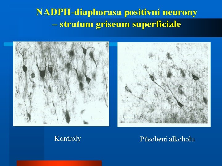 NADPH-diaphorasa positivní neurony – stratum griseum superficiale Kontroly Působení alkoholu 