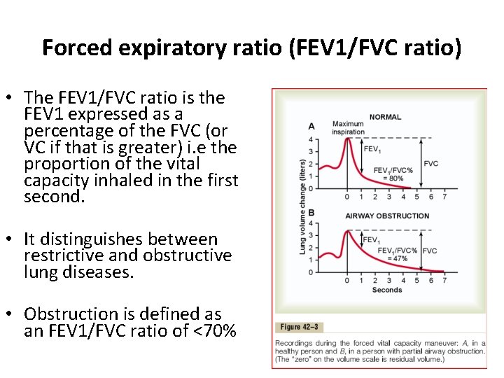 Forced expiratory ratio (FEV 1/FVC ratio) • The FEV 1/FVC ratio is the FEV