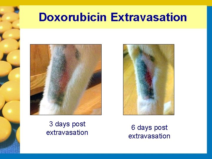 Doxorubicin Extravasation 3 days post extravasation 6 days post extravasation 