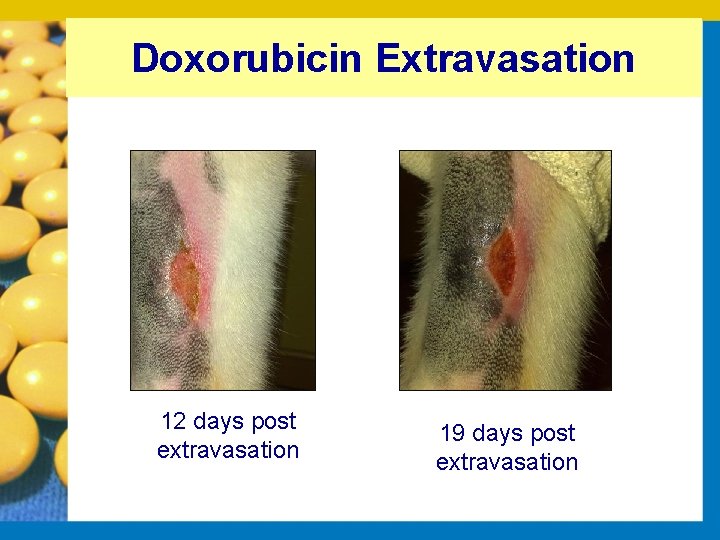 Doxorubicin Extravasation 12 days post extravasation 19 days post extravasation 