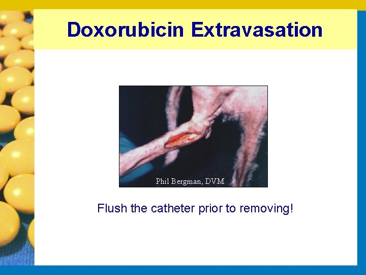 Doxorubicin Extravasation Phil Bergman, DVM Flush the catheter prior to removing! 