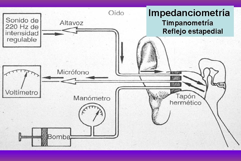 Impedanciometría Timpanometría Reflejo estapedial 