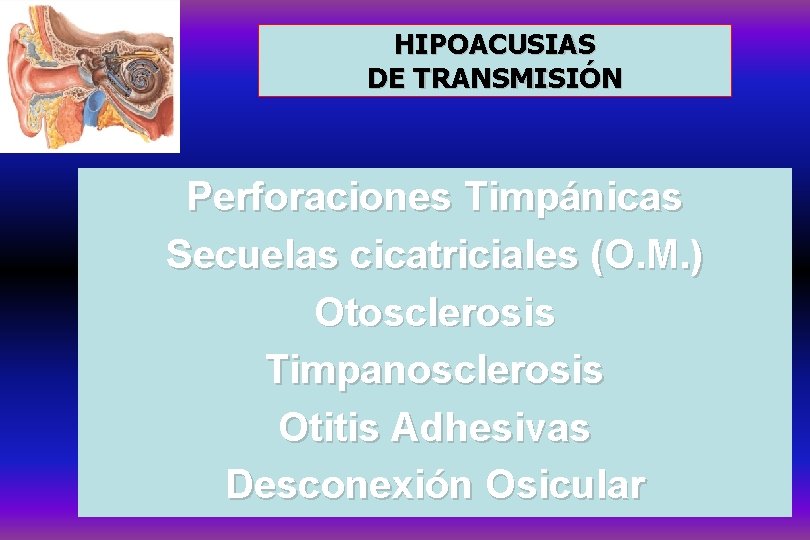 HIPOACUSIAS DE TRANSMISIÓN Perforaciones Timpánicas Secuelas cicatriciales (O. M. ) Otosclerosis Timpanosclerosis Otitis Adhesivas