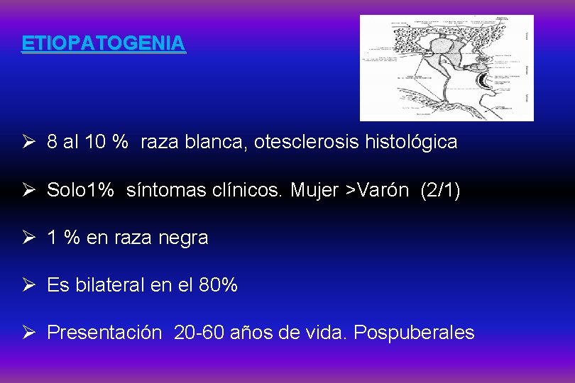 ETIOPATOGENIA Ø 8 al 10 % raza blanca, otesclerosis histológica Ø Solo 1% síntomas