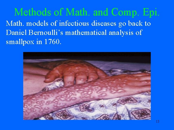 Methods of Math. and Comp. Epi. Math. models of infectious diseases go back to